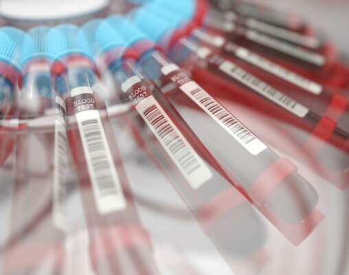 Exames de análise de sangue na SAOC – Saúde Ocupacional