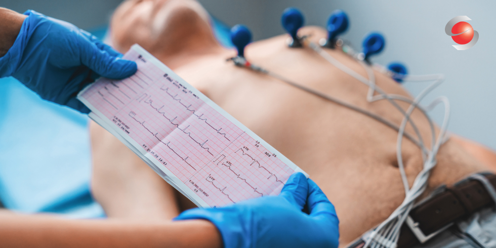 O que é o exame de Eletrocardiograma na Saúde Ocupacional?